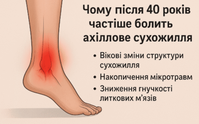 Чому після 40 років частіше болить ахіллове сухожилля