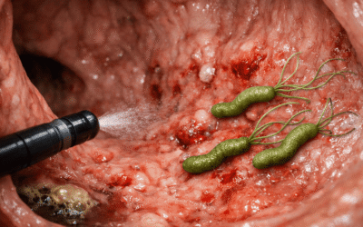Роль Helicobacter pylori у захворюваннях шлунка